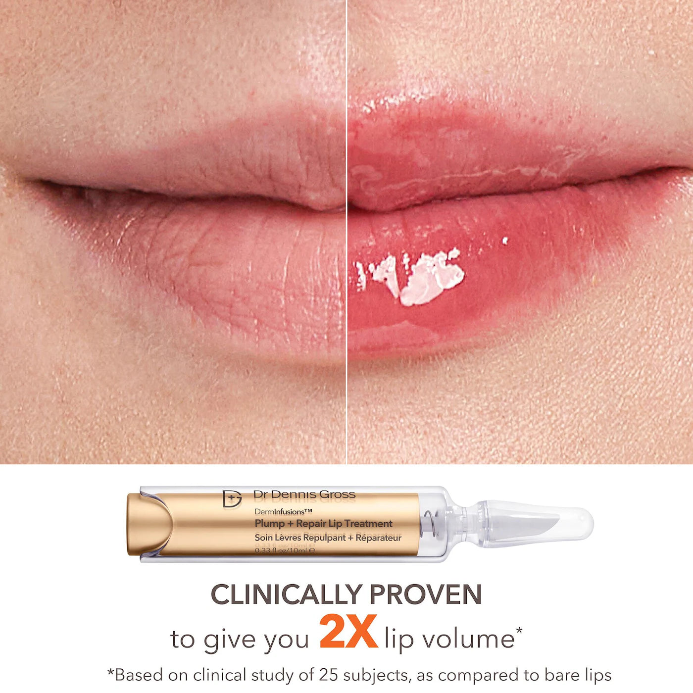 PRE ORDER-Lip Value Set